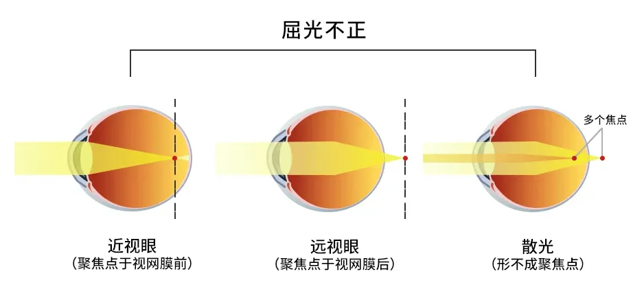 "eye"特所有人,这些细节让眼睛很受伤!_腾讯新闻