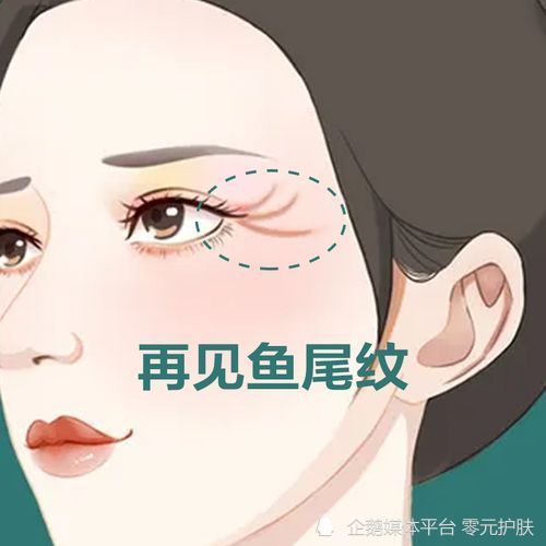 魚尾紋怎麼才能去掉清楚原因才能淡化