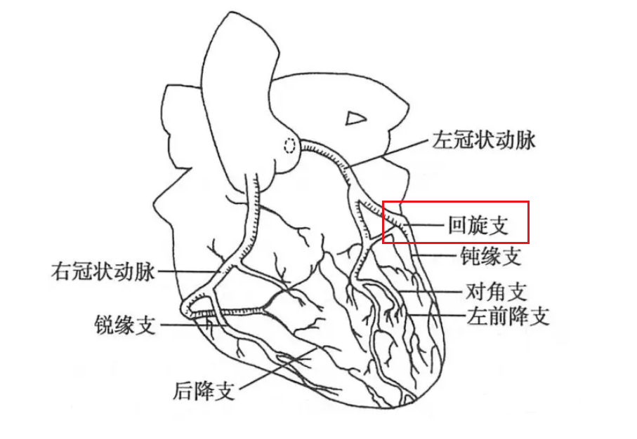 消失了的心臟支架闖出心病患者的另一條生路