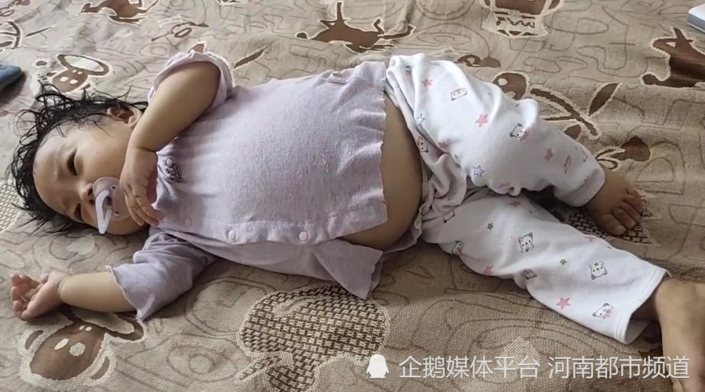 肚大如球,小子涵亟待肝移植爱心捐助:【一岁女童肚大如球】当下是收麦