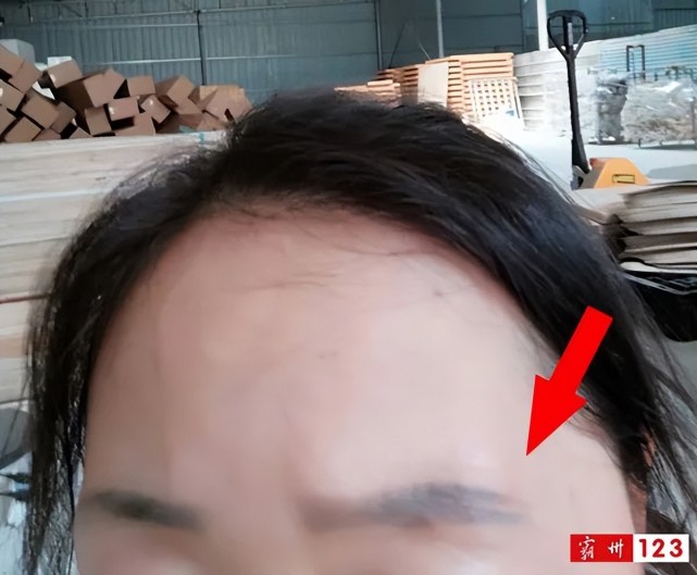 霸州女士维权纹眉出问题引纠纷