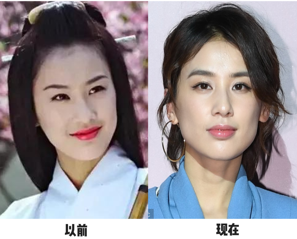 看起来就像胖了十斤本来很精致的小v脸,发腮之后就像充了气的u型起球