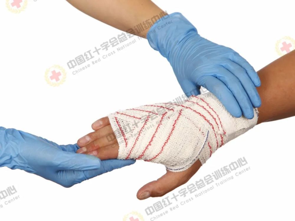 救在身边|现场包扎技术之绷带"8"字包扎_腾讯新闻
