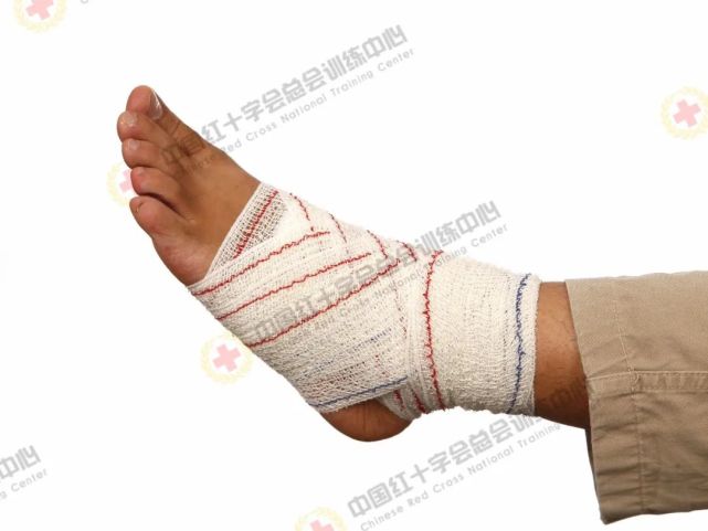 肘关节的"8"字包扎法操作要点1. 伤口用敷料覆盖并固定.2.