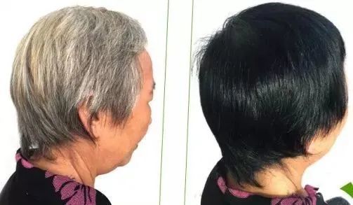 洗一洗,白发变黑,整个人都变年轻!