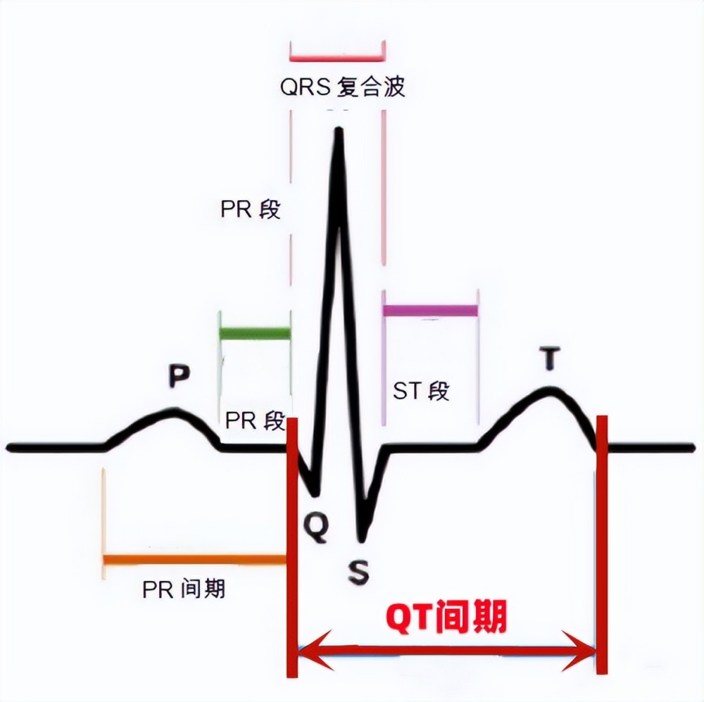 心电图qtc图片