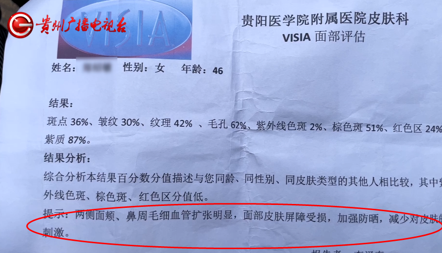 贵州银屑病治疗的新进展