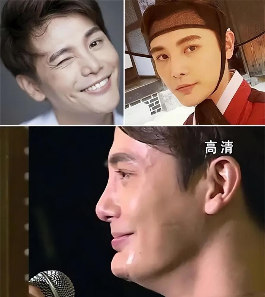 演艺圈"花式假下巴"大比拼,又尖又翘又吓人,一个比一个精彩_腾讯新闻