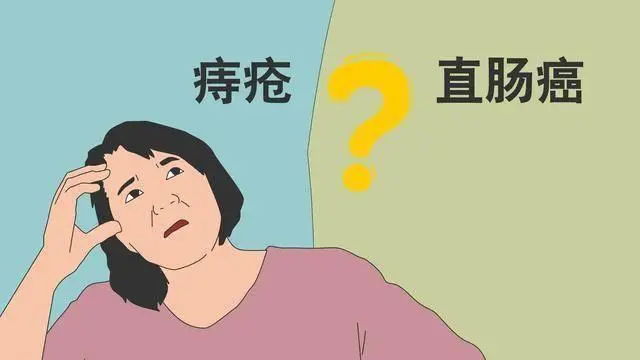 柳州東大肛醫院正規嗎:直腸癌與痔瘡的鑑別