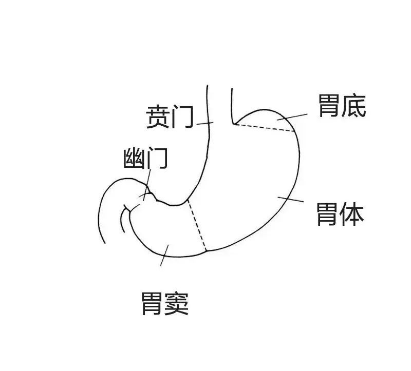 胃癌手绘图图片