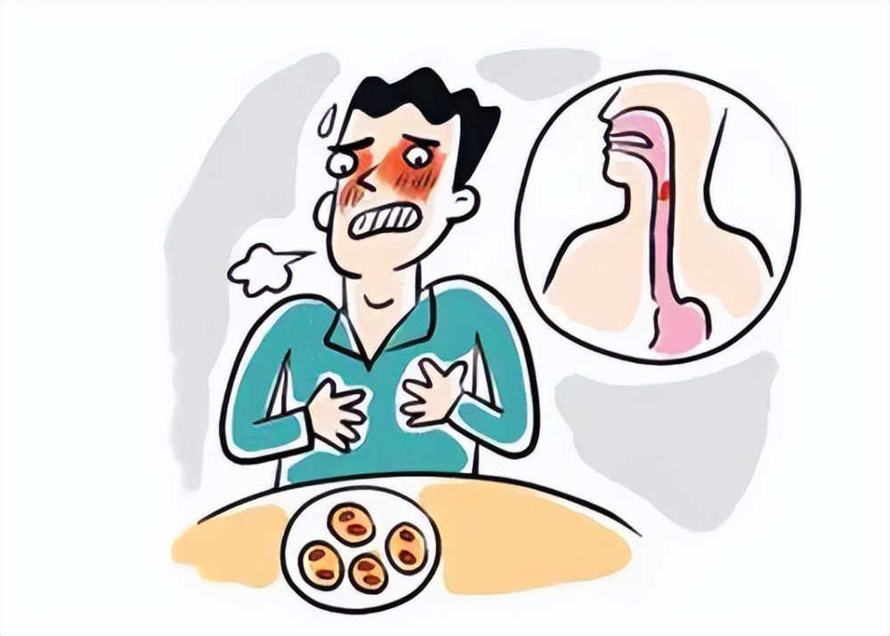 食管癌漫画图片