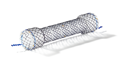 segmental stents是一款通过hanarostent技术制备的食道支架.