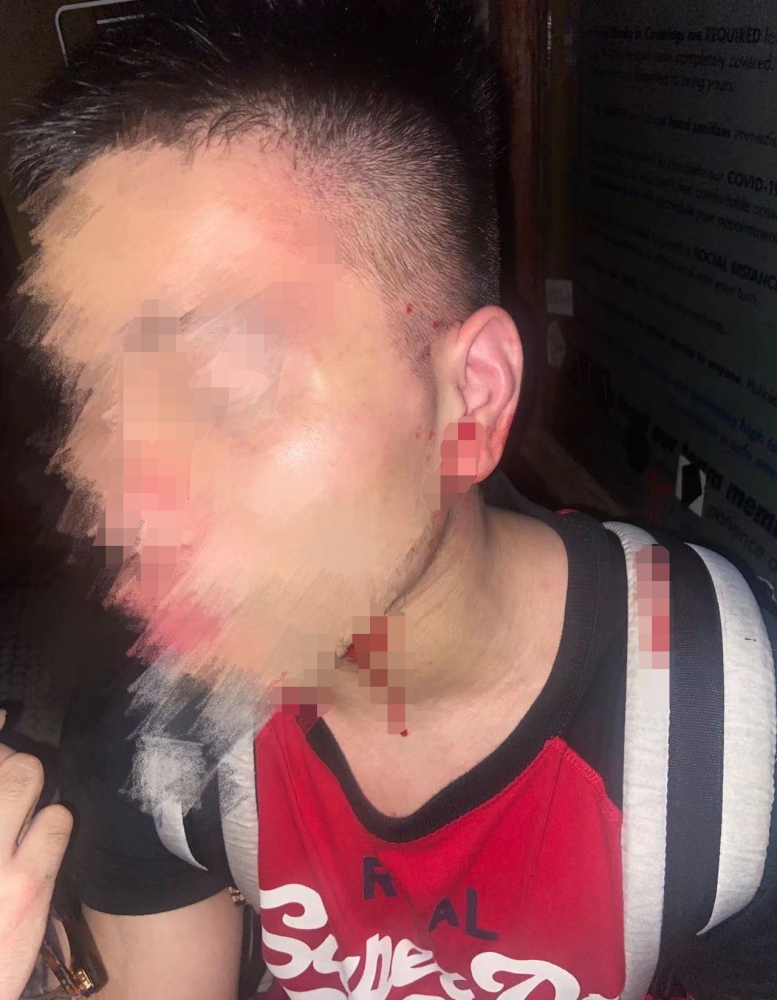 一名中国博士生在美国遭多人袭击耳朵被打流血警方发袭击者照片寻线索乐锄教育集团