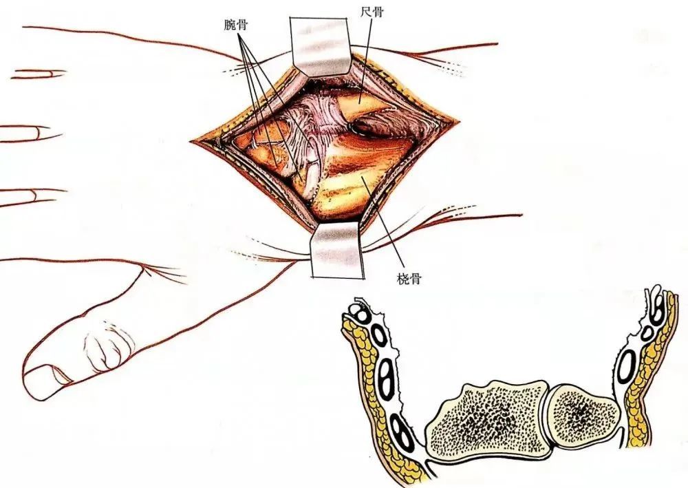 腕關節背側入路的解剖應用和技巧詳解