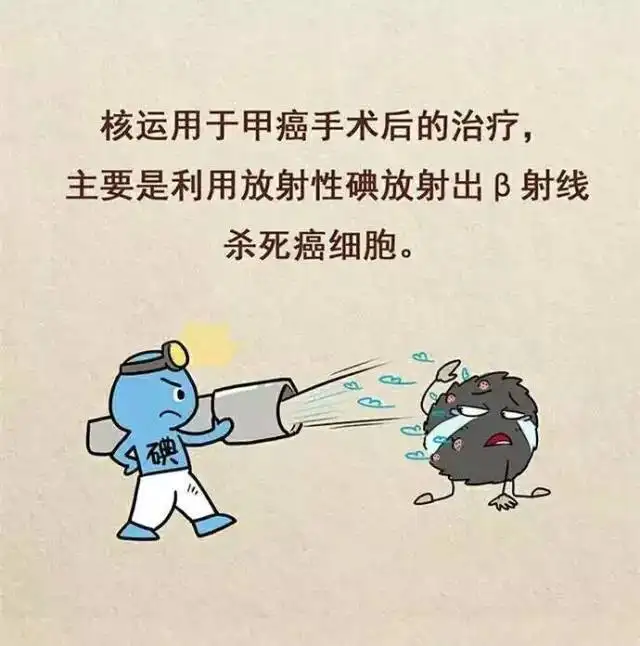 甲状腺癌术后碘131治疗原理,方法,注意事项及影响