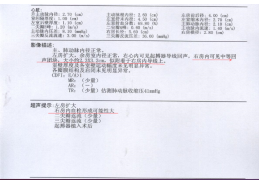 入院后超声心动图检查结果见超声报告,提示右房内血栓形成可能性大.