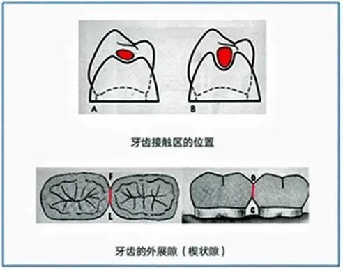 牙齿邻面接触点位置图片