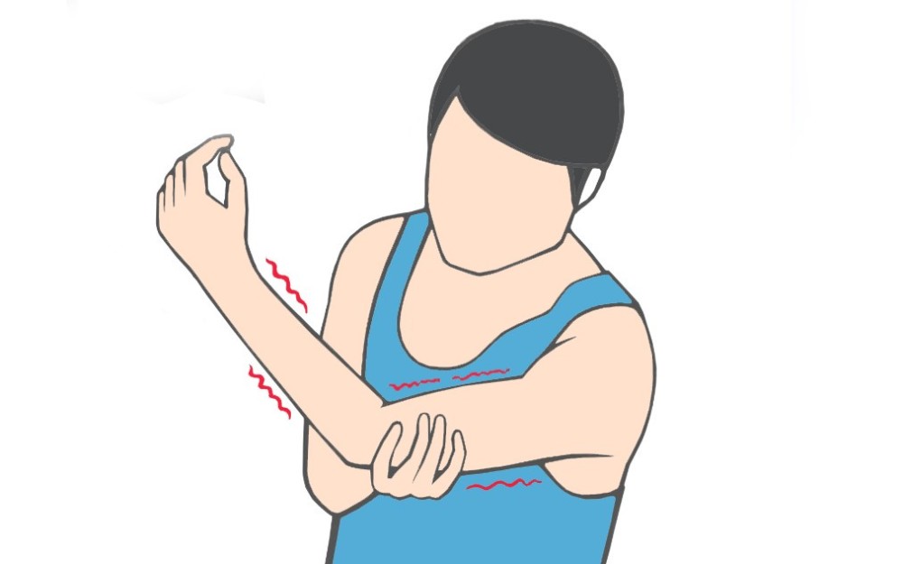 颈椎病引起的手麻是什么样的?_腾讯新闻