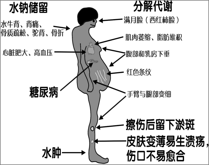 李惠萍教授:糖皮质激素治疗间质性肺疾病:何时用?多大量?怎么停?
