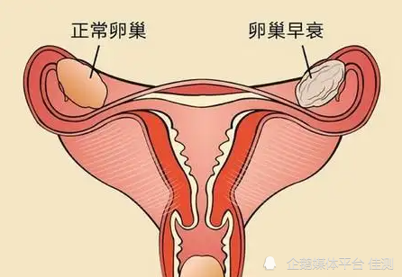 卵巢早衰危害大,不孕不育早更的5個信號,趕緊自查