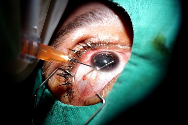 手术后装的假眼球图片图片