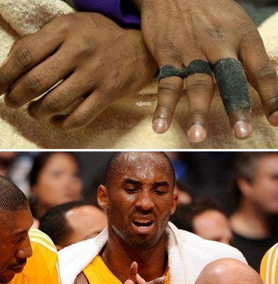 nba球星真是透支健康赚钱詹皇脚趾似外星人科比手指变形