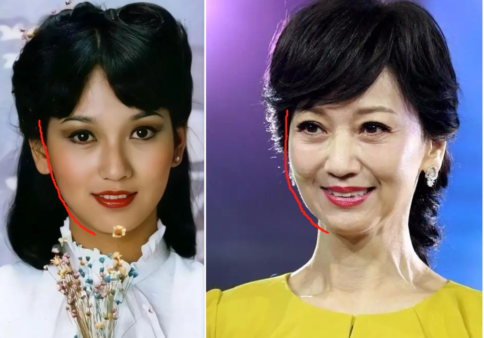 别再说高颧骨,方下颌抗老了!真正耐老的脸,得具备这3个条件插图9