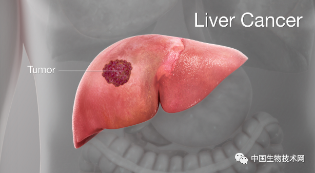science子刊一种关键蛋白被释放后促进了肥胖相关肝癌的进展