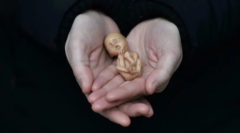 40天堕胎的孩子图片图片