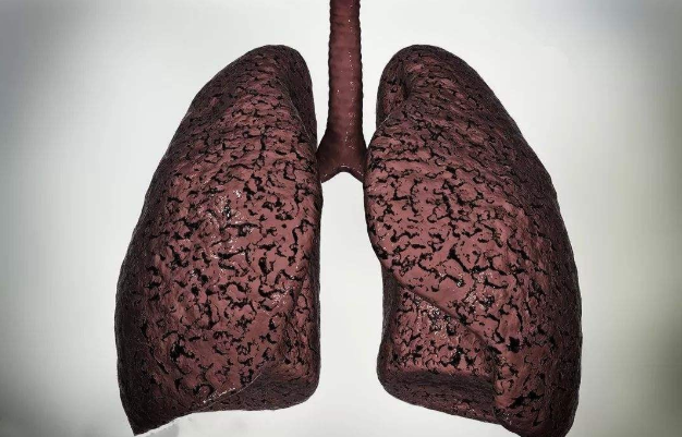 想知道自己的肺是否健康?从这3个地方能看出来.