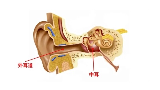 經常掏耳朵會致癌是真的,這些正確方法你應該掌握