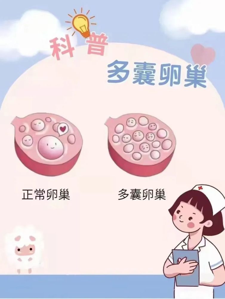 好妈妈孕!多囊卵巢千万别吃黄体酮"科学管理"-第1张图片-思度网