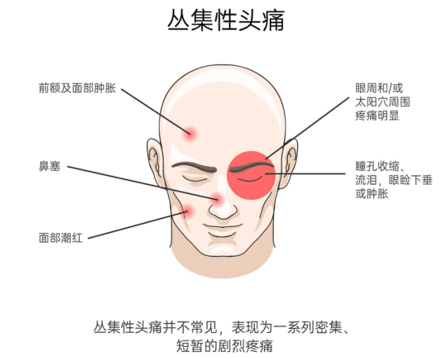 头疼示意图图片