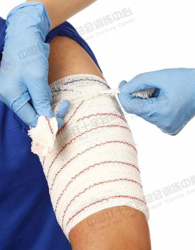 应急救护科普现场包扎技术之绷带螺旋包扎