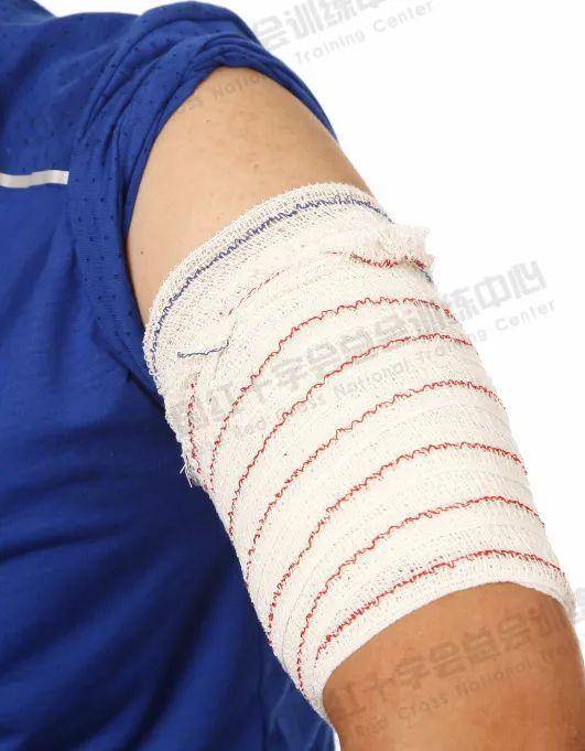 应急救护科普现场包扎技术之绷带螺旋包扎