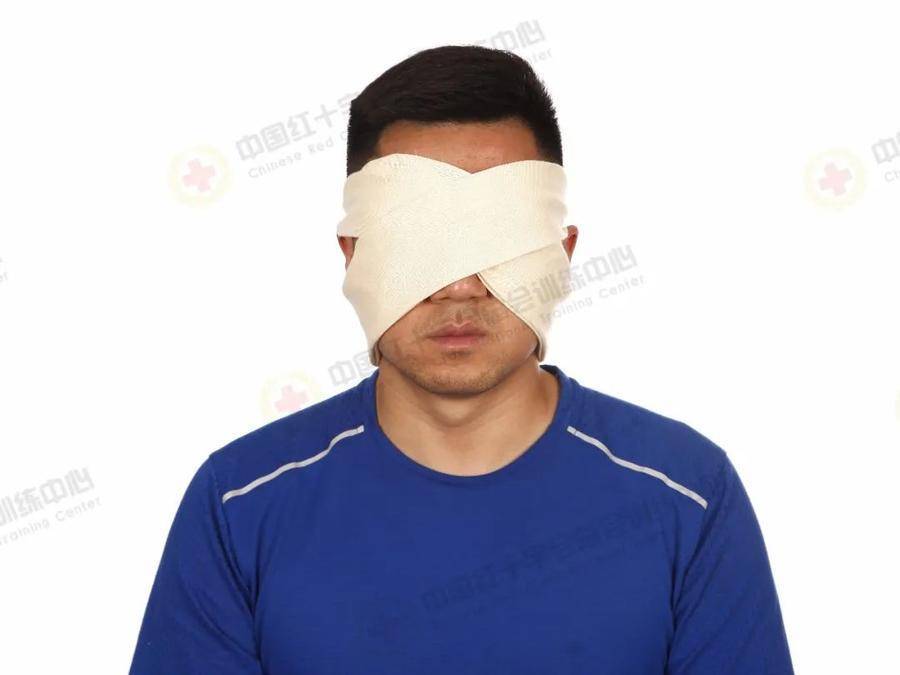 应急救护科普现场包扎技术之三角巾双眼包扎