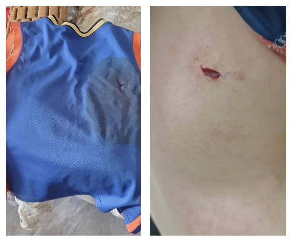后背被玻璃渣戳伤了经过一番检查孩子随即哭着喊疼爷爷和孩子被飞溅的