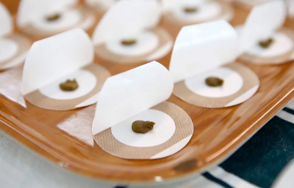 岭南传统天灸开贴啦中医专家支招日常养生调理妙招