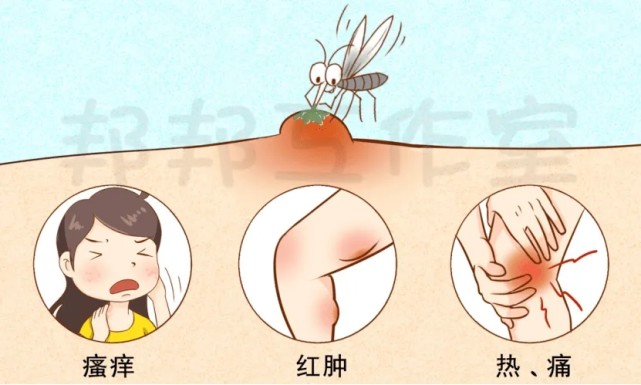 警惕蚊虫叮咬引发丘疹性荨麻疹