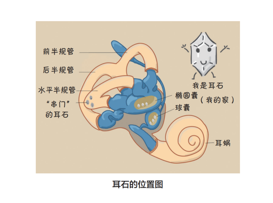 柔和的眩晕症是什么原因导致的的视图