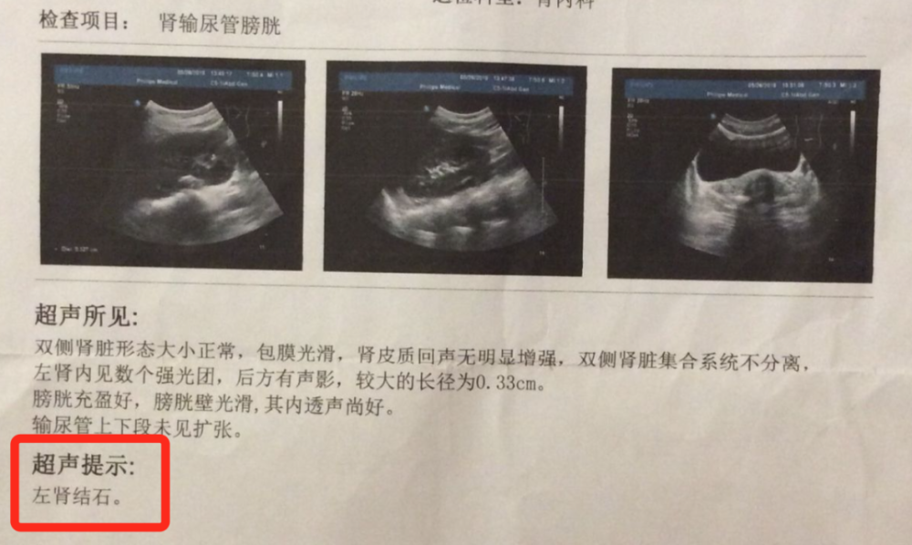 當圈內第一腿精再也不“靠腿吃飯”，性感指數反而狂飆暴漲了？1962年初中語文書第一冊