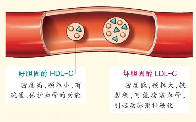 好胆固醇又被表扬了它对大脑和血管都很友好