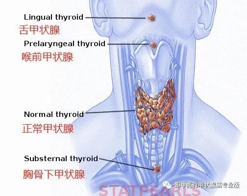 820甲狀腺的輪廓形態與甲狀腺癌精準觀察