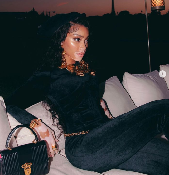 库兹马白癜风超模女友狂秀恩爱!奇才大将喂女友蟹腿肉超宠溺