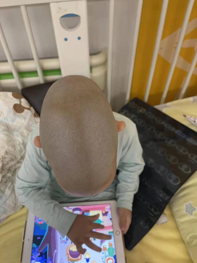 私立诊所儿保三年未发现孩子颅缝早闭?卓正医疗:正和家长协商