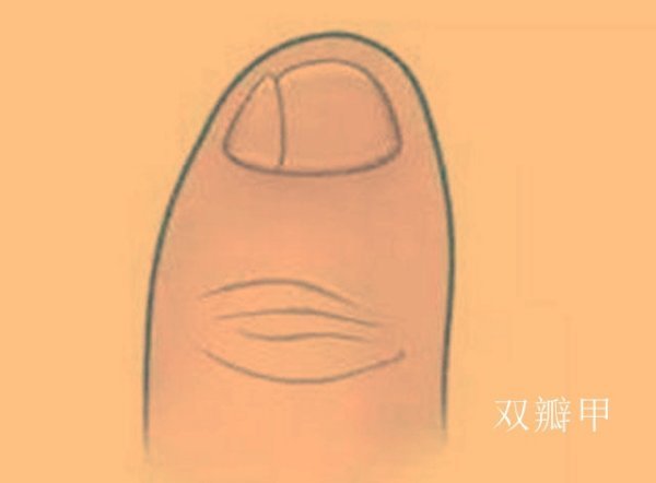 体质人类学领域,对于蒙古人种的典型特征有这样几个概括:比如铲形门齿