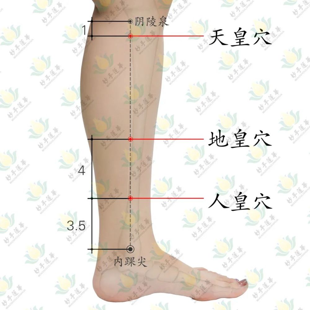 人皇穴和天皇穴,地皇穴统称为下三皇,是董氏特效穴中强壮补肾的重要