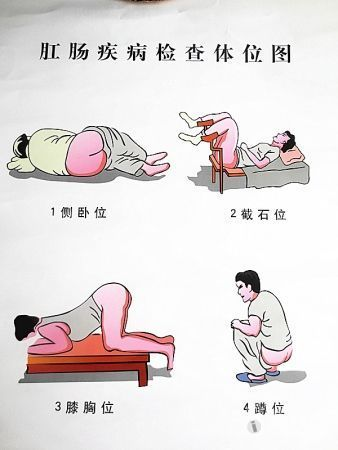 时隔一年肛拭子又上热搜啦