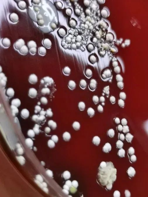 图5:亚洲诺卡菌培养3天在血琼脂平板菌落形态图4:改良弱抗酸染色