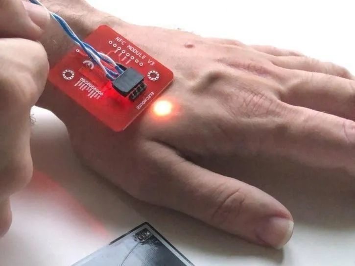 半机械人,微芯片植入者正渐渐接管世界|cyberdaily_腾讯新闻